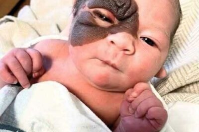 Mom on a mission to show daughter with extremely rare birthmark that she is beautiful